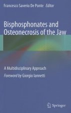 Bisphosphonates and Osteonecrosis of the Jaw: A Multidisciplinary Approach