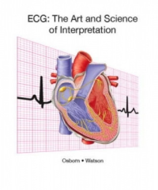 ECG