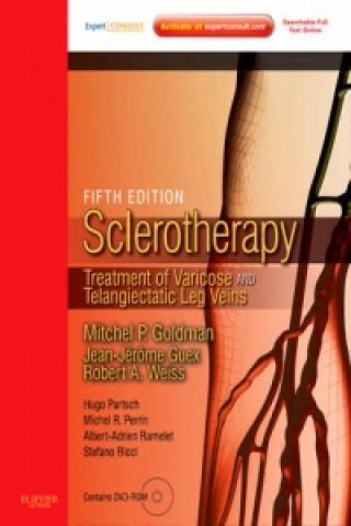 Sclerotherapy Expert Consult - Online and Print