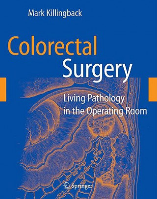 Colorectal Surgery