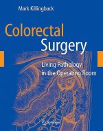 Colorectal Surgery