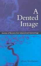 Dented Image