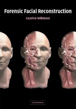 Forensic Facial Reconstruction