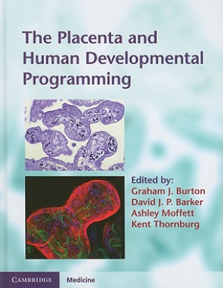 Placenta and Human Developmental Programming