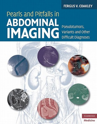 Pearls and Pitfalls in Abdominal Imaging