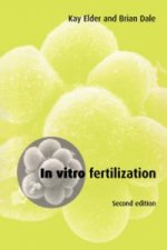 In Vitro Fertilization