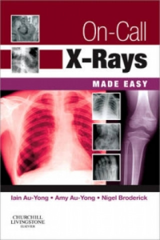 On-Call X-Rays Made Easy