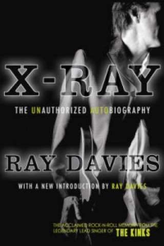 X-ray