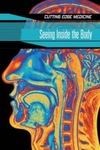 Seeing Inside the Brain