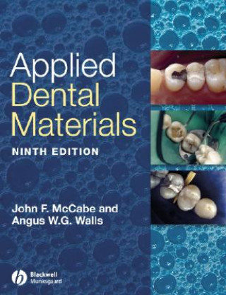 Applied Dental Materials 9e