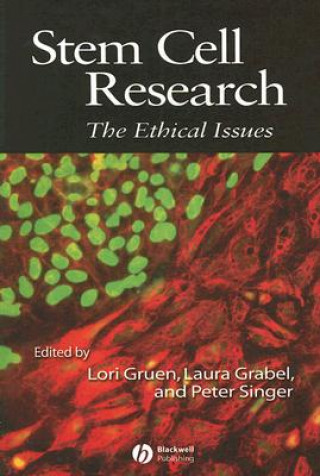 Stem Cell Research - The Ethical Issues