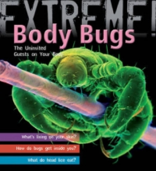 Extreme Science: Body Bugs!