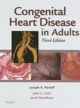 Congenital Heart Disease in Adults