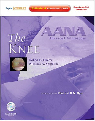 AANA Advanced Arthroscopy: The Knee
