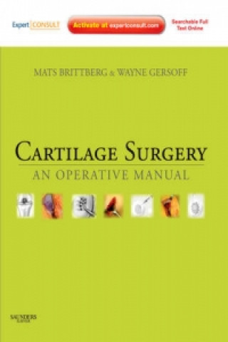 Cartilage Surgery