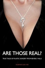 Are Those Real?