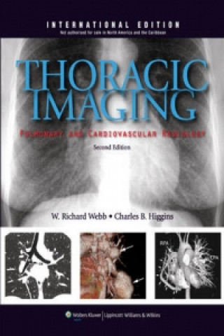 Thoracic Imaging: Pulmonary and Cardiovascular Radiology