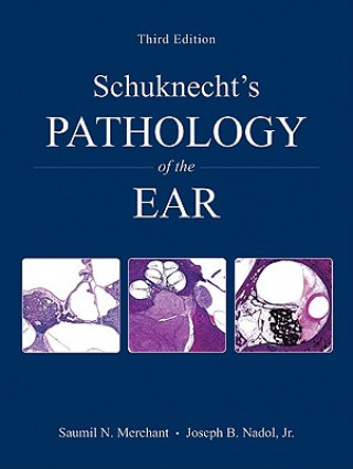 Schuknecht's Pathology of the Ear