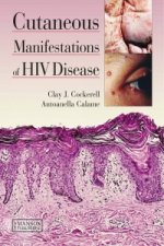 Cutaneous Manifestations of HIV Disease