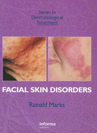 Facial Skin Disorders