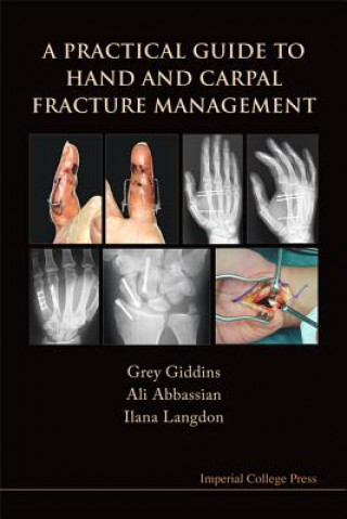Practical Guide To Hand And Carpal Fracture Management, A