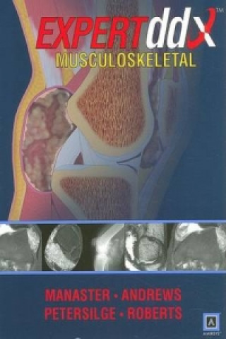 Expert Differential Diagnoses: Musculoskeletal
