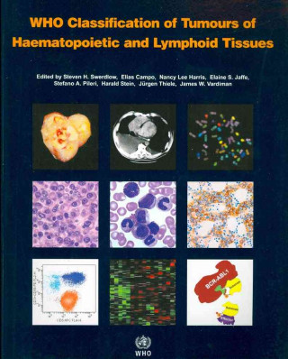 WHO Classification of Tumours of Haematopoietic and Lymphoid Tissues