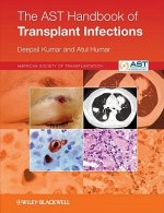 AST Handbook of Transplant Infections