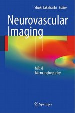 Neurovascular Imaging