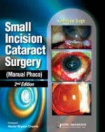 Small Incision Cataract Surgery (Manual Phaco)