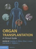 Organ Transplantation