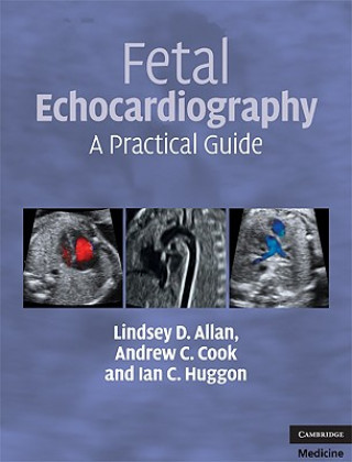 Fetal Echocardiography