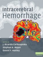 Intracerebral Hemorrhage