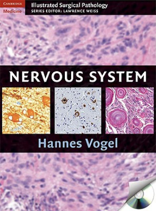 Nervous System