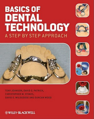 Basics of Dental Technology