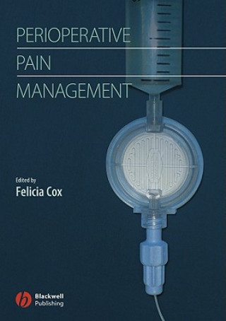 Handbook of Perioperative Pain Management