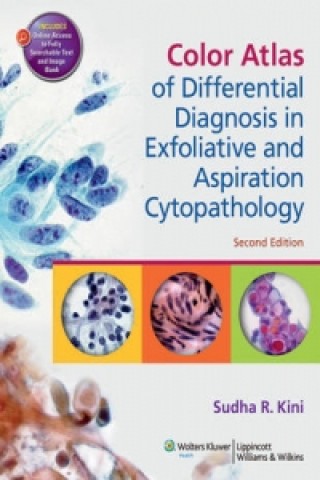 Color Atlas of Differential Diagnosis in Exfoliative and Aspiration Cytopathology