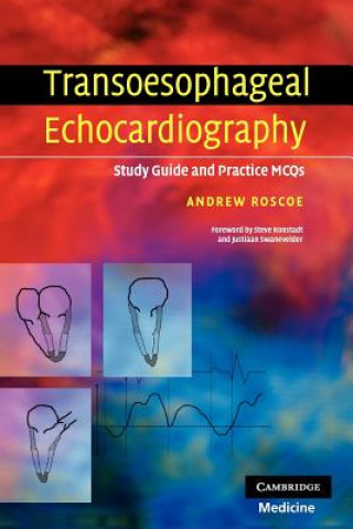 Transoesophageal Echocardiography