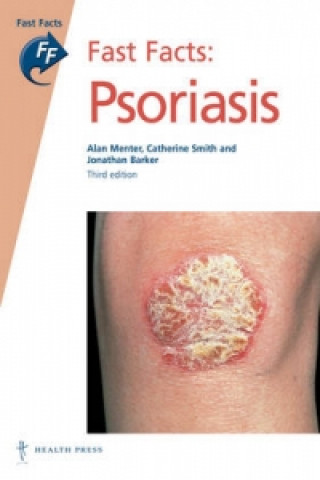 Fast Facts: Psoriasis