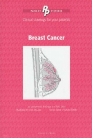 Patient Pictures: Breast Cancer