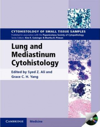 Lung and Mediastinum Cytohistology with CD-ROM