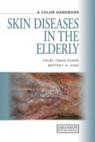 Skin Diseases in the Elderly