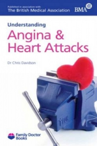 Understanding Angina and Heart Attacks