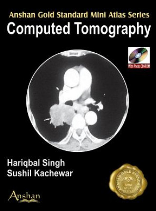 Mini Atlas of Computed Tomography