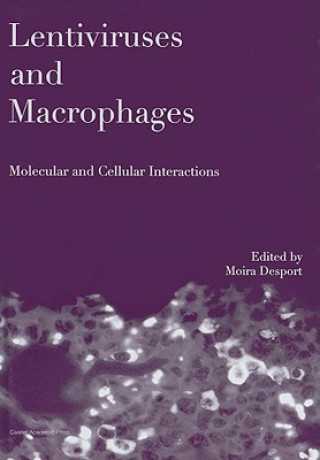 Lentiviruses and Macrophages: Molecular and Cellular Interac