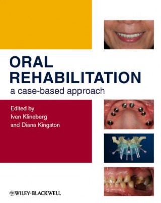 Oral Rehabilitation - A Case-Based Approach (Iven Klineberg)(Pevná)