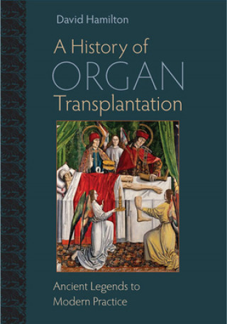 History of Organ Transplantation