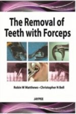 Removal of Teeth with Forceps