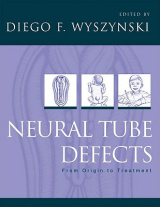 Neural Tube Defects