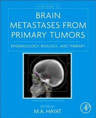 Brain Metastases from Primary Tumors, Volume 2